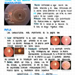 Cuaderno digital - Oftalmología