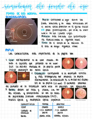 Cuaderno digital - Oftalmología